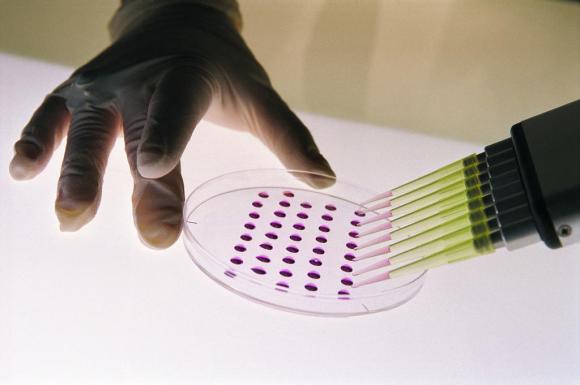 Un laboratorista pone dei campioni di cellule staminali embrionali su un vetrino
