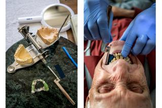 uno stampo dentale e primo piano delle mani dentista nella bocca di un anziano