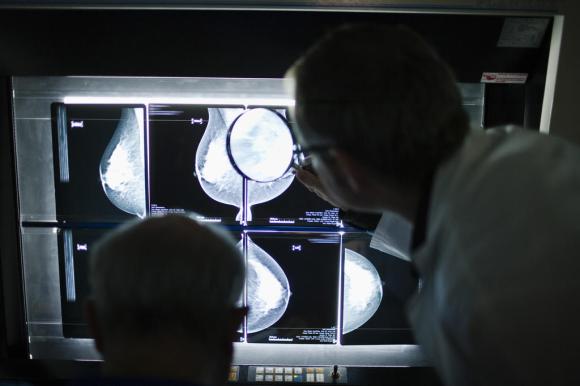 Medici consultano i risultati di una mammorgrafia