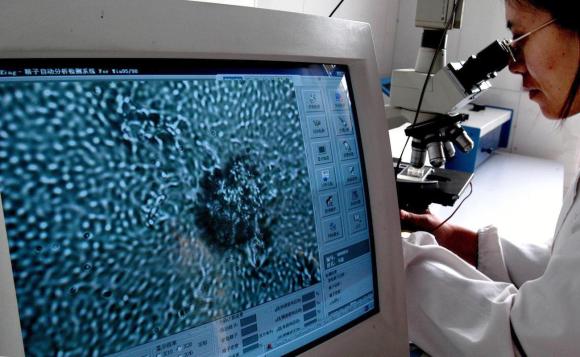 Una donna al microscopio e sul video sui vedono milioni di spermatozoi