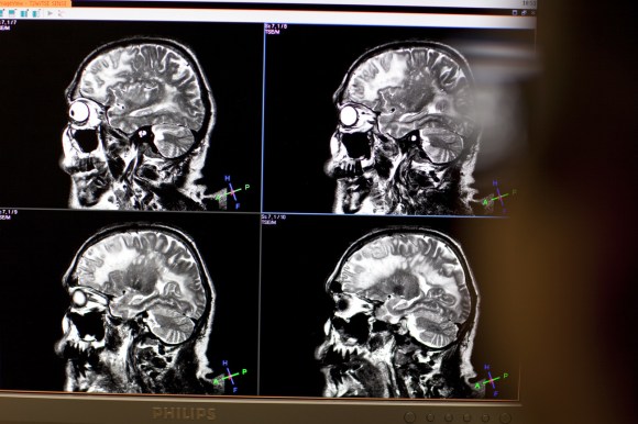 Neuroscienziati controllano l attività cerebrale di una persona durante un esperimento.