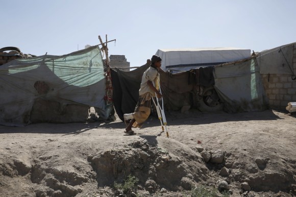 uomo con stampelle e piede destro bendato in un campo profughi yemenita