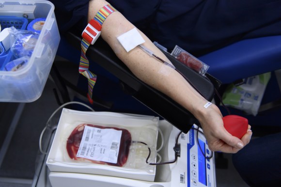 braccio di una persona durante una donazione di sangue