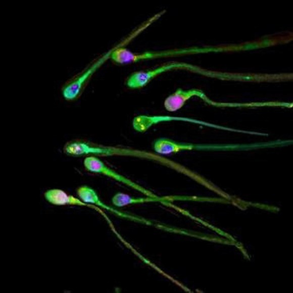 Spermatozoi umani al microscopio.